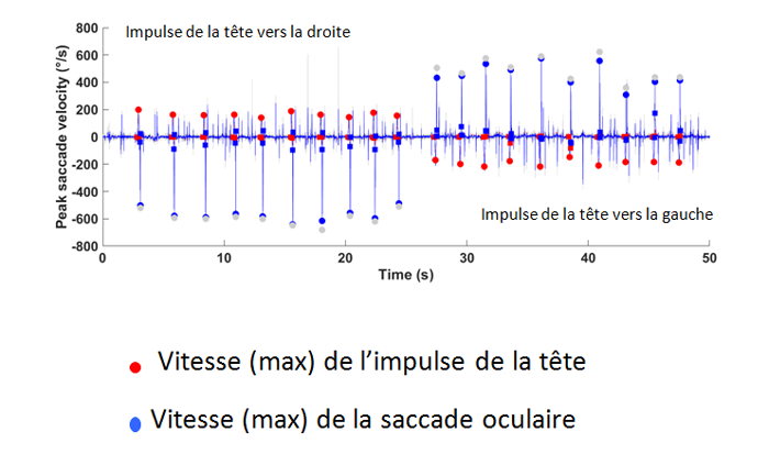 Les différents examens vestibulaires pour le diagnostic des vertiges